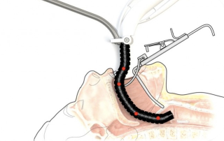 Illustration for article titled Oh Great, Surgeons Want To Shove These Robot Snakes Down Our Throats